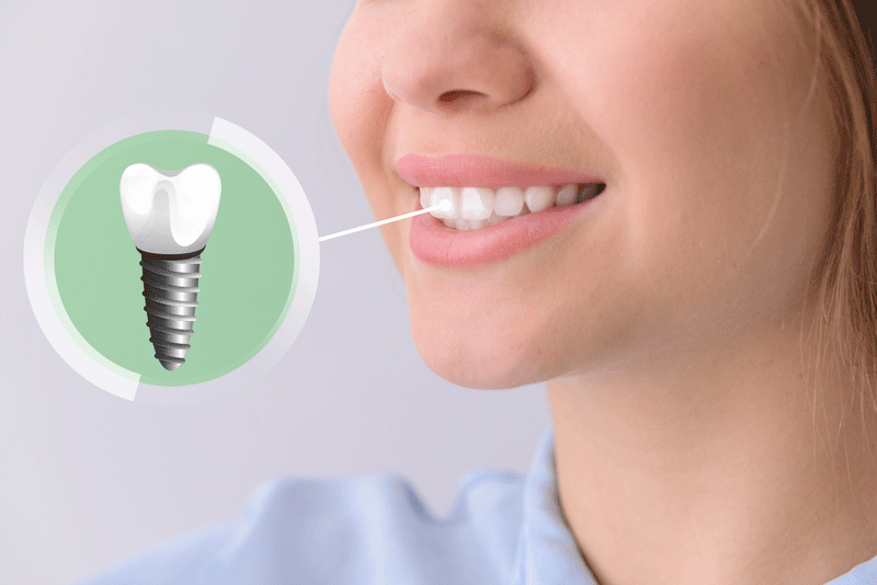 Young woman with implanted teeth on color background, closeup.