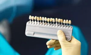 Top-down photo of a doctor holding a set of different colored tooth crowns; blurred background.