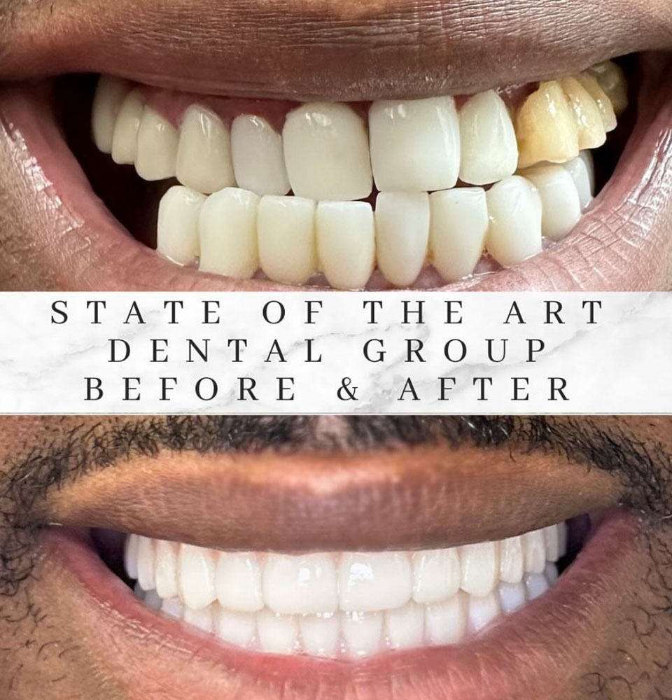 Another Happy Patient - Before & After Image