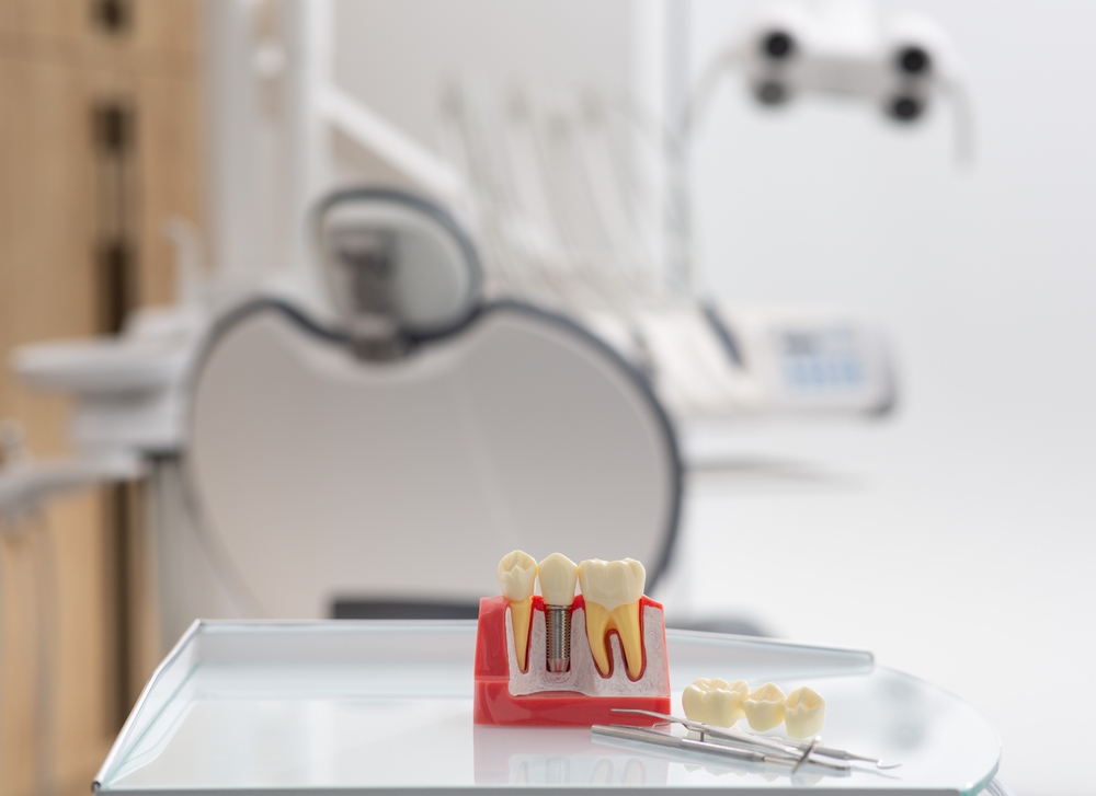 Photo of a dentist smiling and pointing to a digital x-ray of a full mouth dental implant on a monitor, while consulting with a patient in a modern dental office. No text on image.